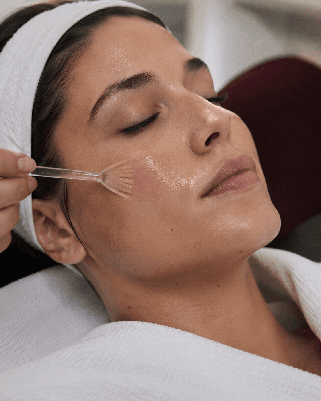 Peeling Chimique