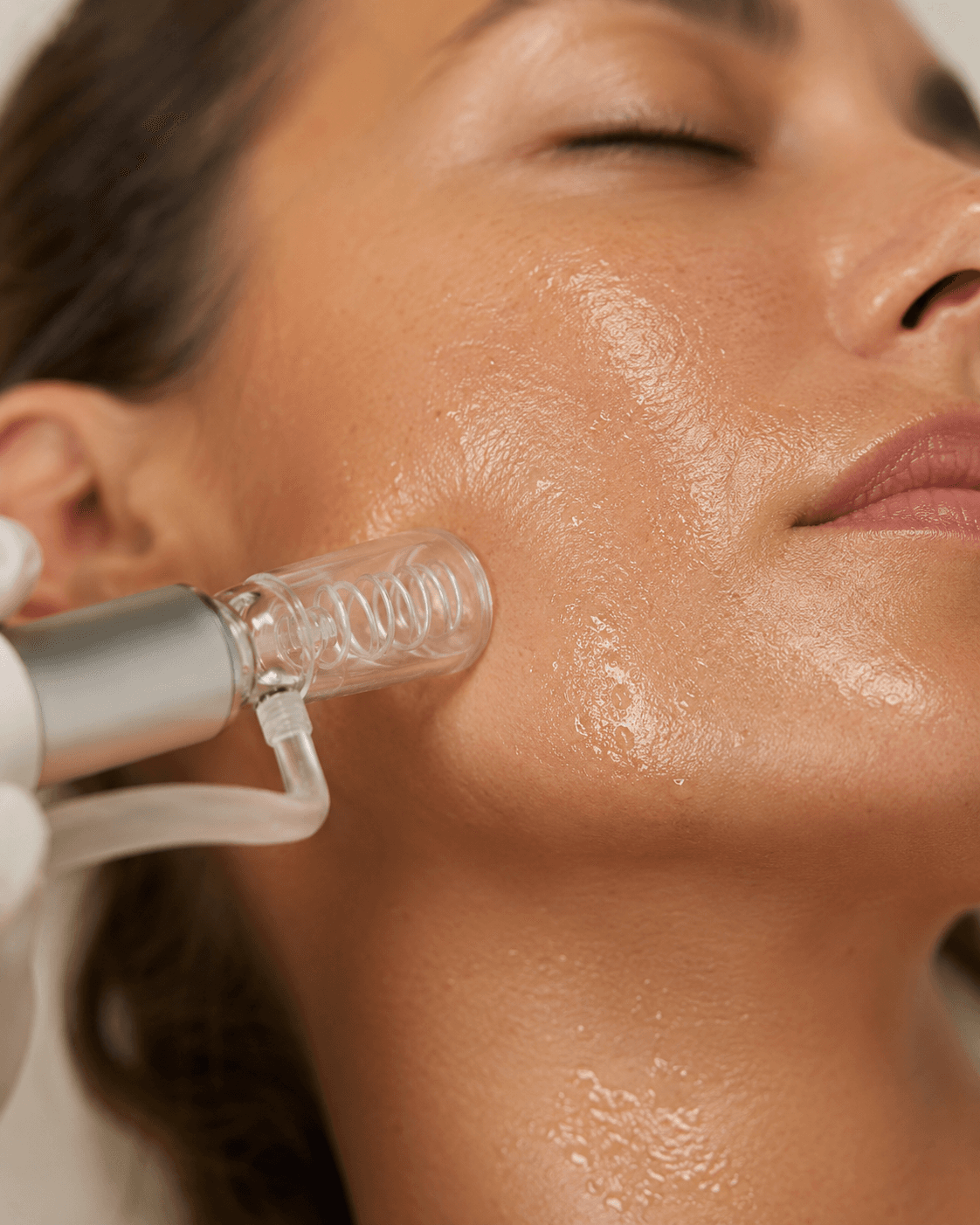 Hydra Dermabrasion